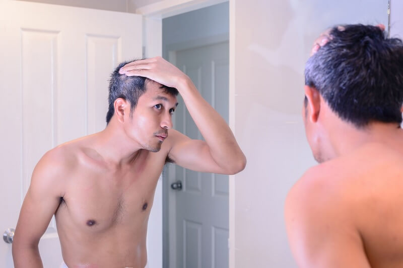 Cara Mengatasi Rambut Beruban di Usia Muda